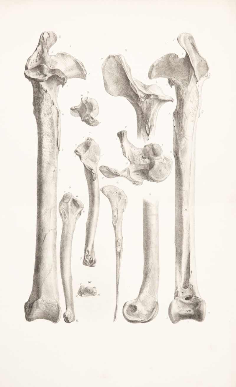 Bone Density: The Psychology of Marble Bone Disease