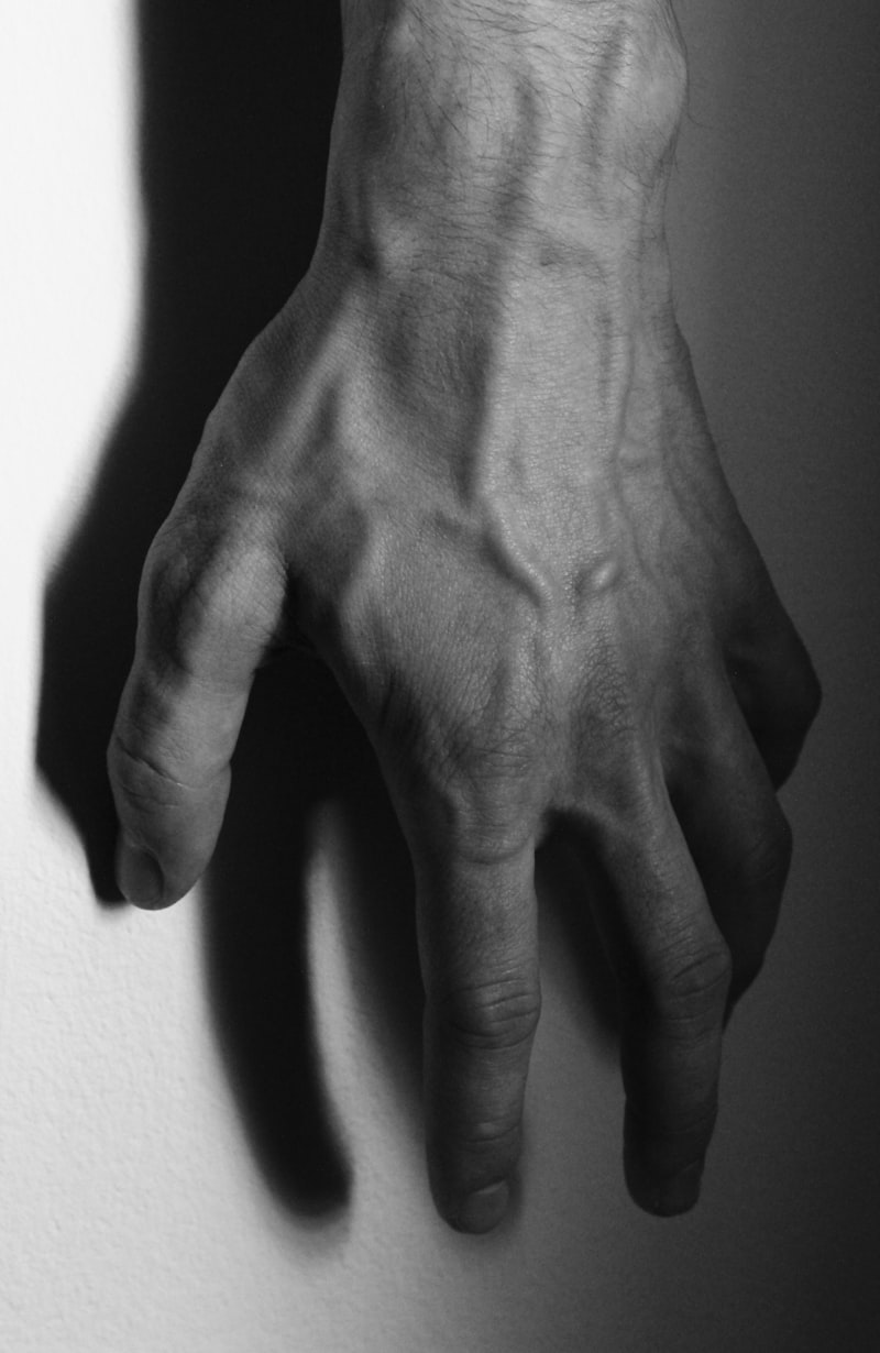 Alien Hand Syndrome: When Your Limb Has a Mind of Its Own