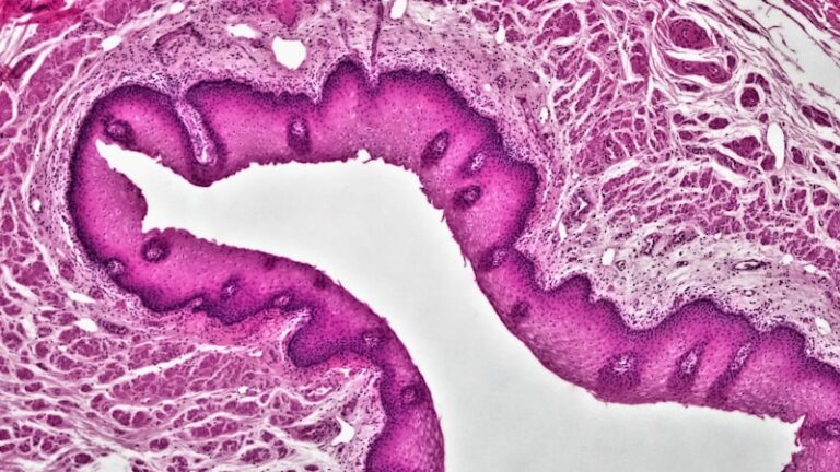Microglossia: Understanding Rare Oral Development