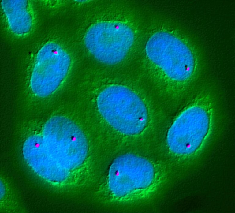 ON Cells: How Light Shapes Your Visual Perception
