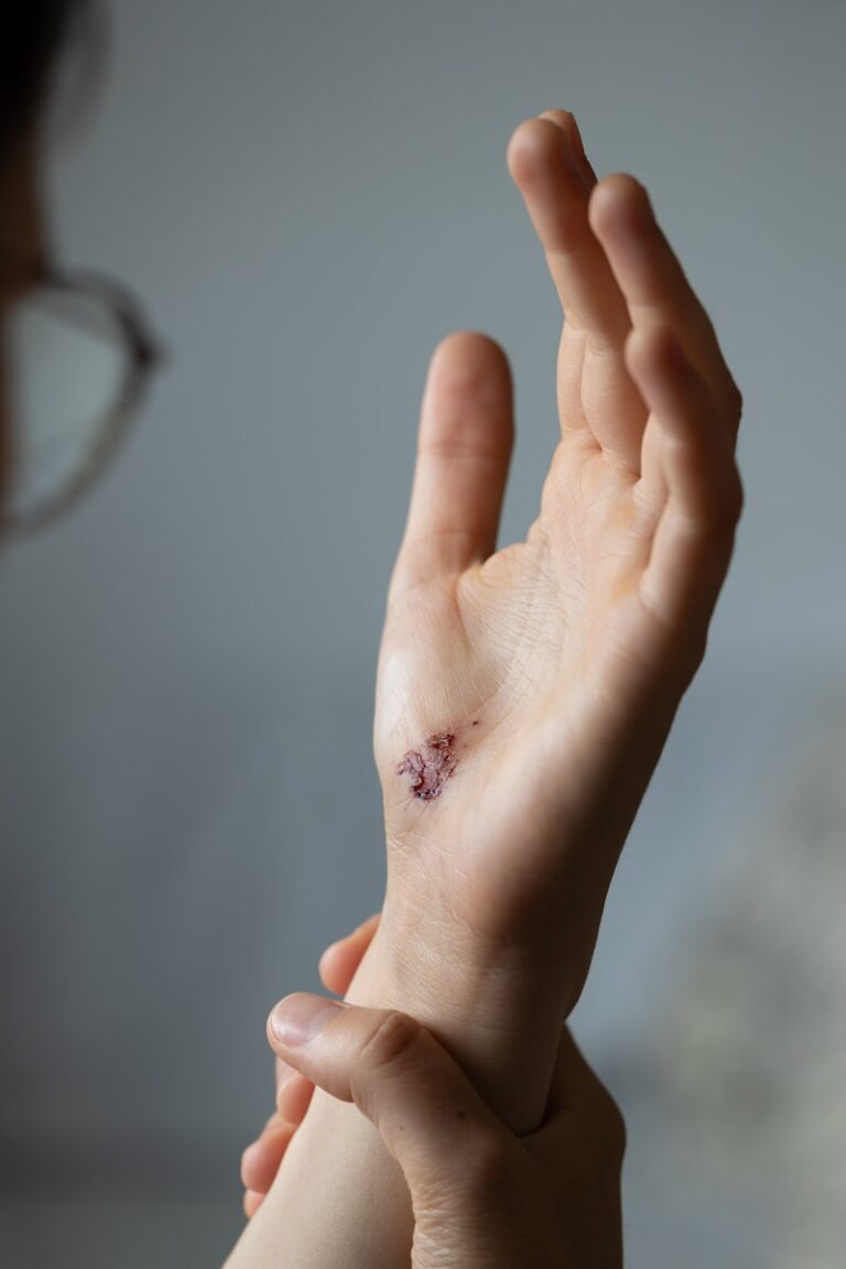 Psychological Trauma: Healing the Invisible Bruise