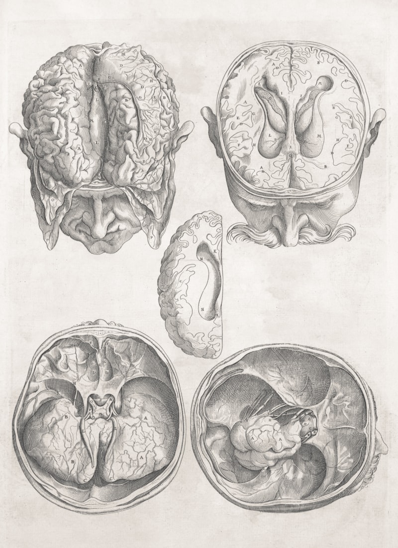 The Anorthoscope: Visualizing Complex Mental Dimensions