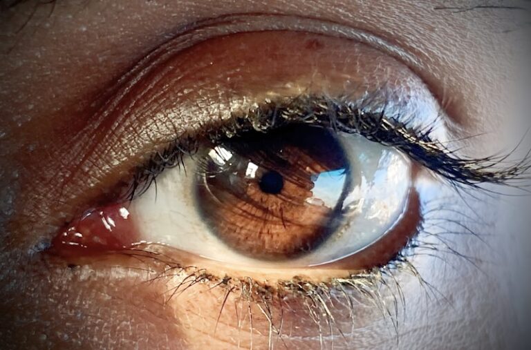 The Ophthalmic Nerve: Sensory Gateways to Perception