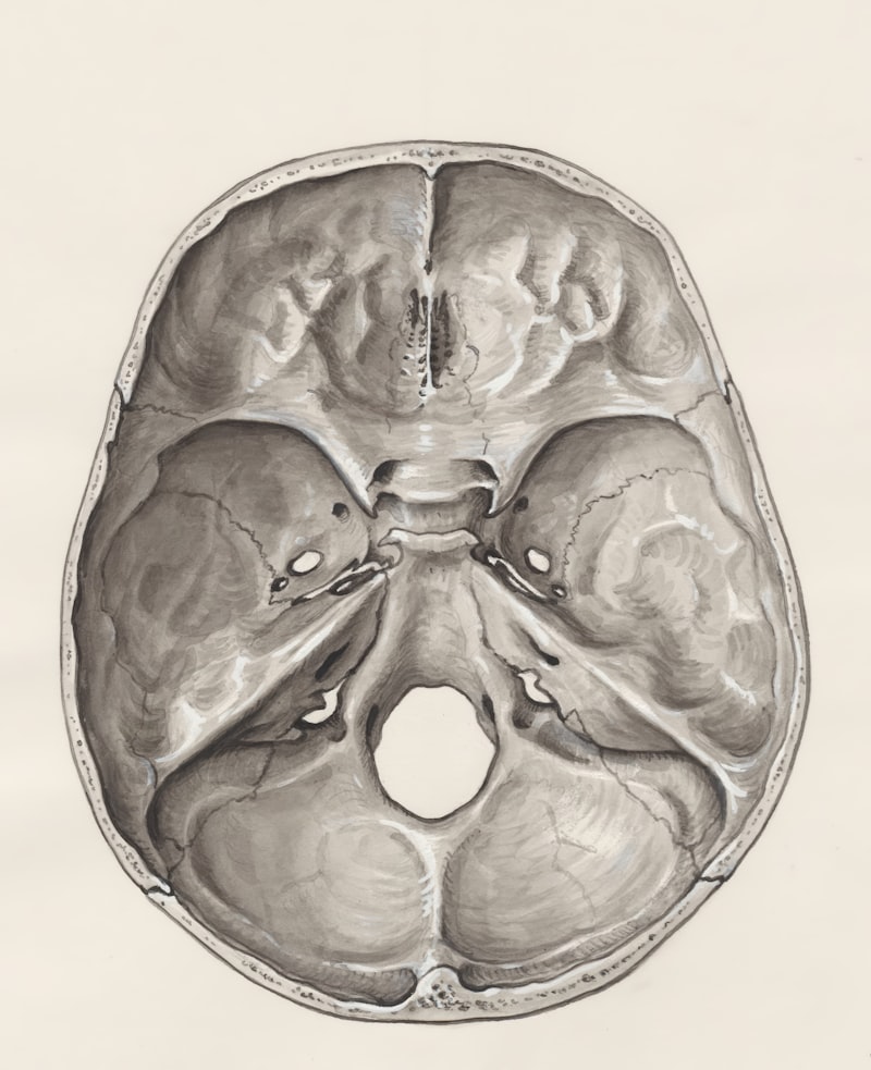 Acrocephaly: Understanding the Impact of Cranial Shape