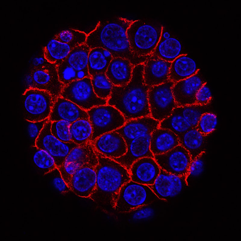 Amacrine Cells: Unlocking the Retina's Hidden Intelligence