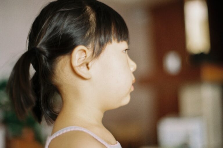 Precocious Puberty: Decoding Early Developmental Shifts