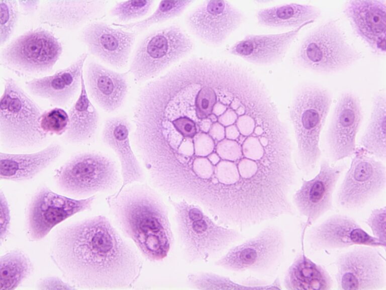 Sertoli Cells: The Silent Architects of Male Vitality