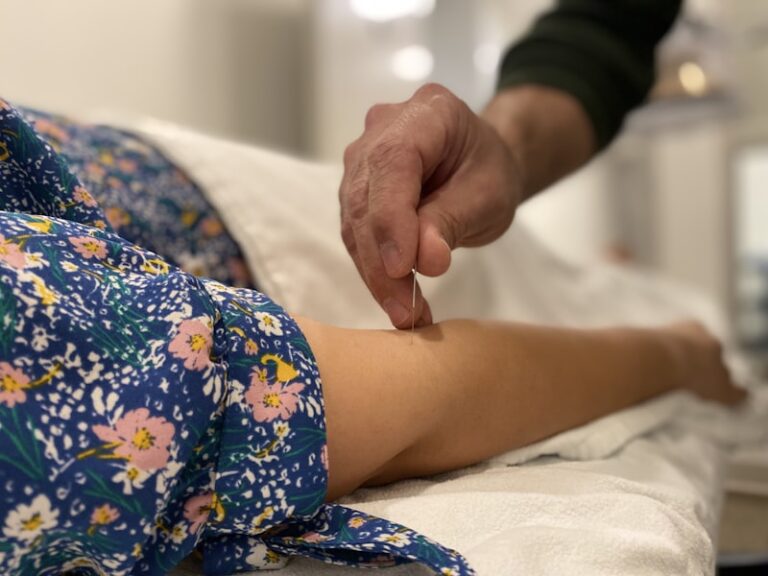 Acupuncture: Mind-Body Healing for Modern Stress