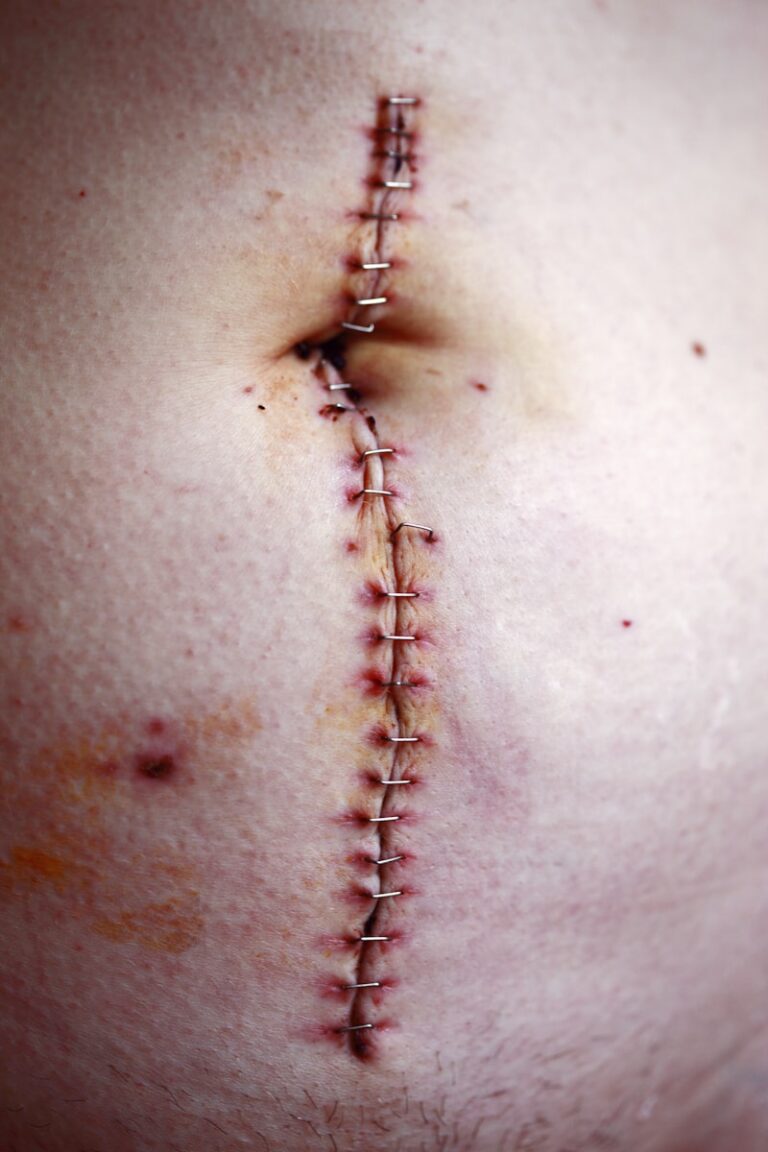 Battered-Child Syndrome: Healing the Invisible Scars