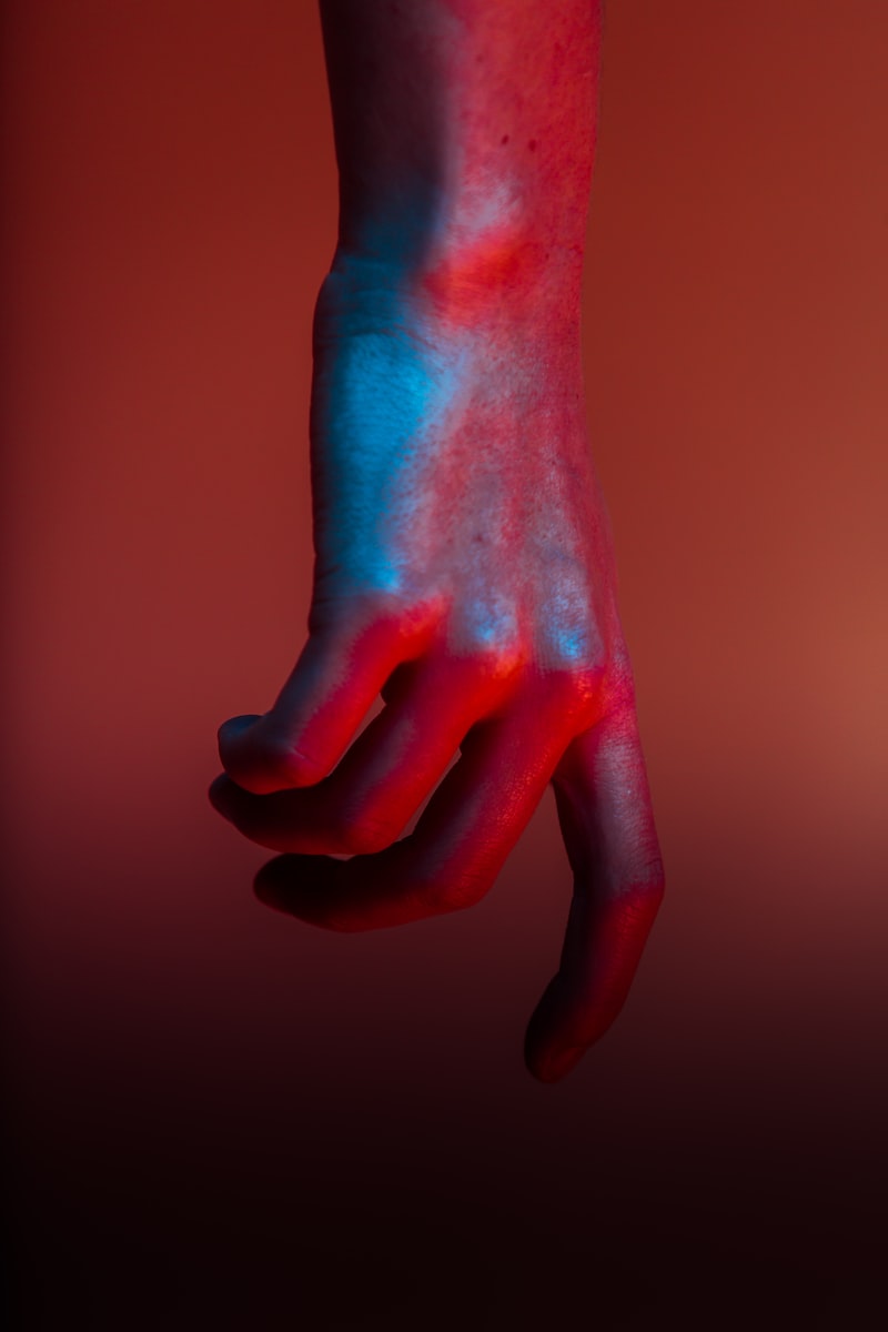 Psychosomatic Vascularity: When Stress Turns Fingers Cold