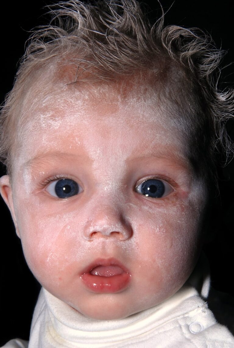 Wildervanck Syndrome: Decoding a Rare Congenital Triad