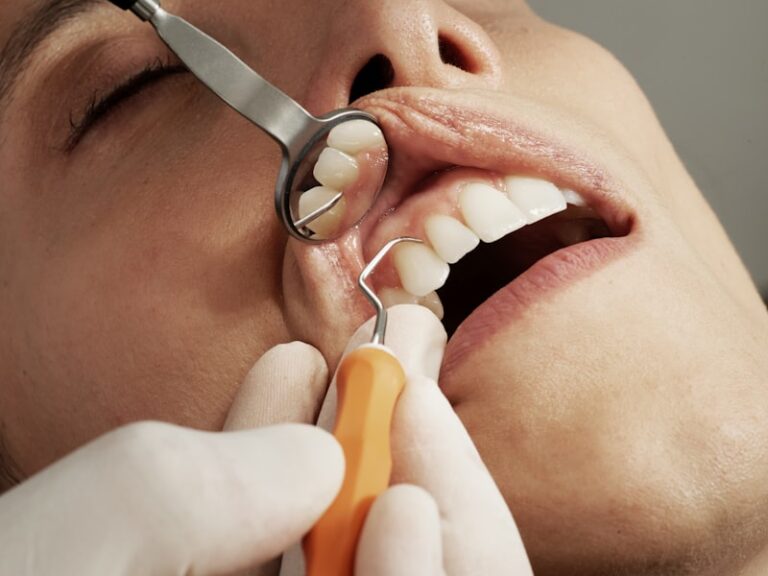 Dental Hygiene: The Hidden Mindset for a Healthier Smile
