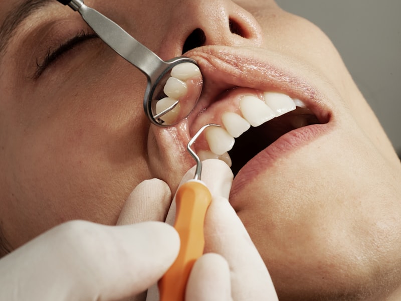Dental Hygiene: The Hidden Mindset for a Healthier Smile