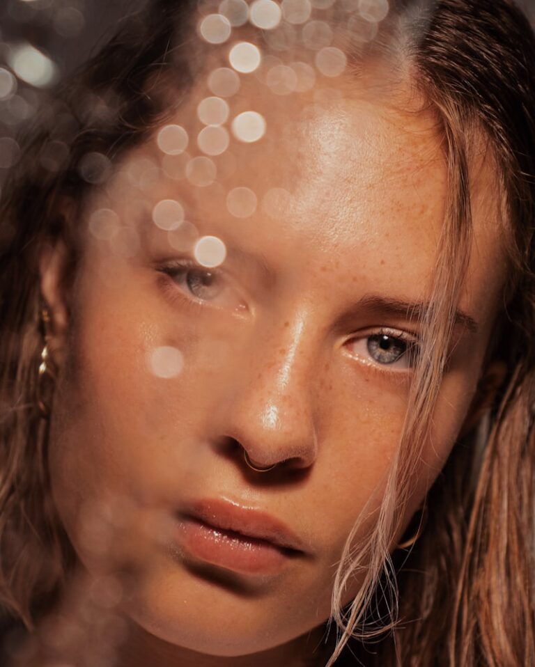 Isotretinoin: The Psychological Impact of Clear Skin