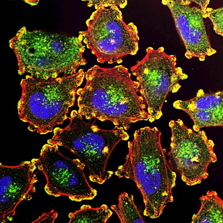 Mucosal Immunology: How M-Cells Shape Your Internal Defenses
