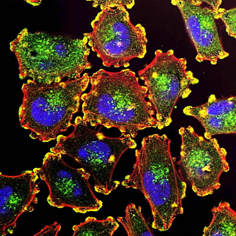 Mucosal Immunology: How M-Cells Shape Your Internal Defenses