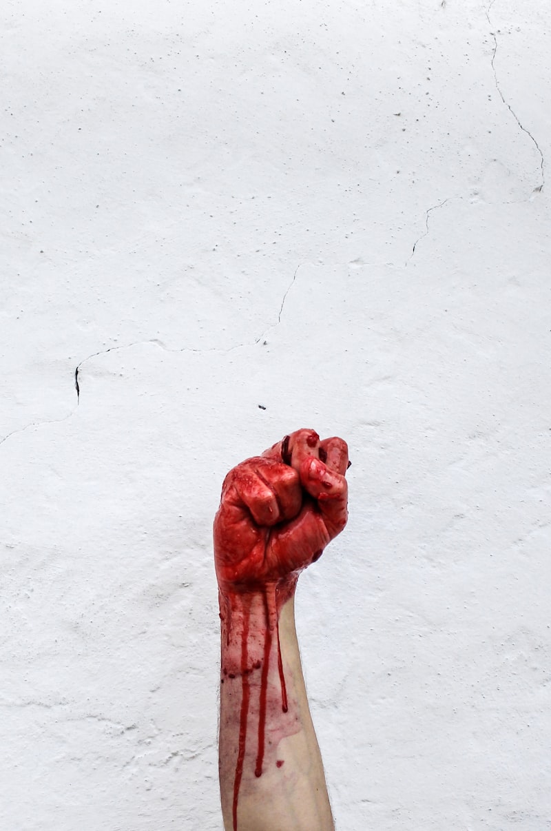 Hemophobia: Understanding Your Fear of Blood