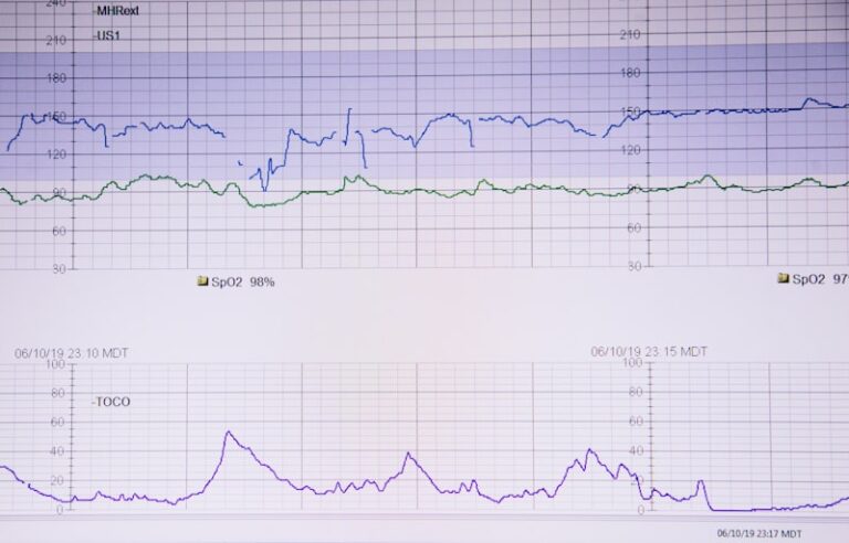 Longitudinal Research: Tracking Change Over Time