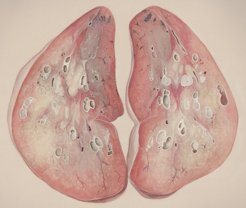 Psychosomatic Breath: How Your Lungs Mirror Your Stress