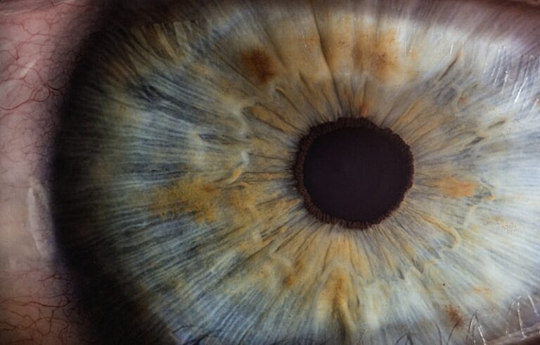 Visual Perception: Understanding the World of Eye Floaters
