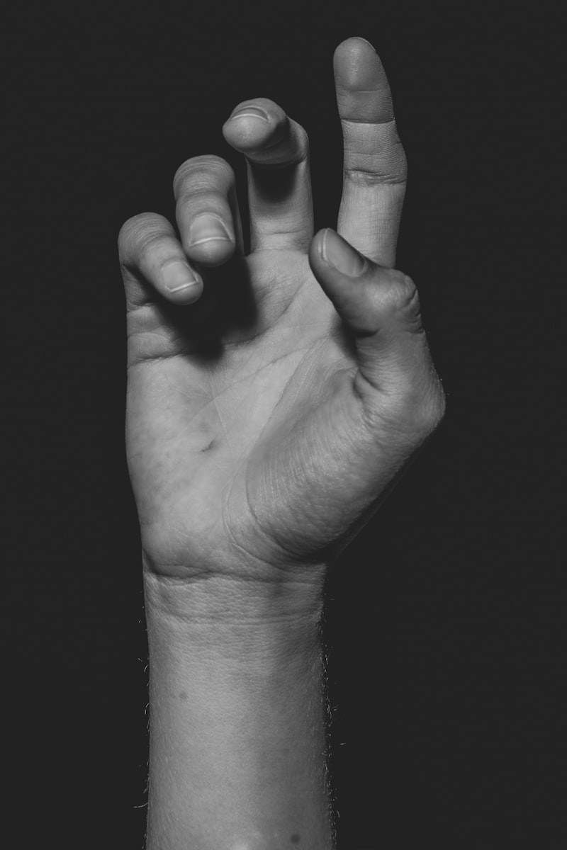 Alien Hand Syndrome: When Your Limb Acts Alone
