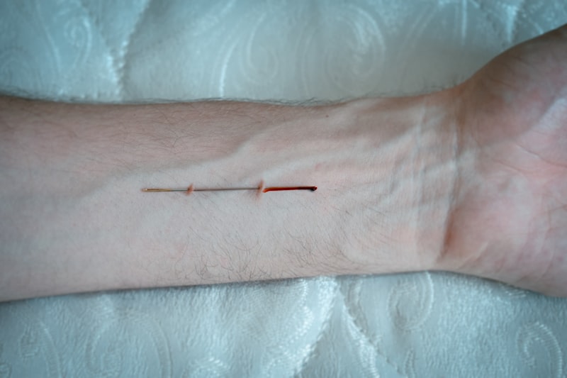 Applied Tension: Conquer Your Fear of Needles and Blood