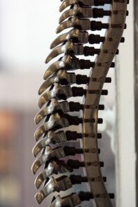 Brown-Sequard Syndrome: Decoding Split Spinal Pathways