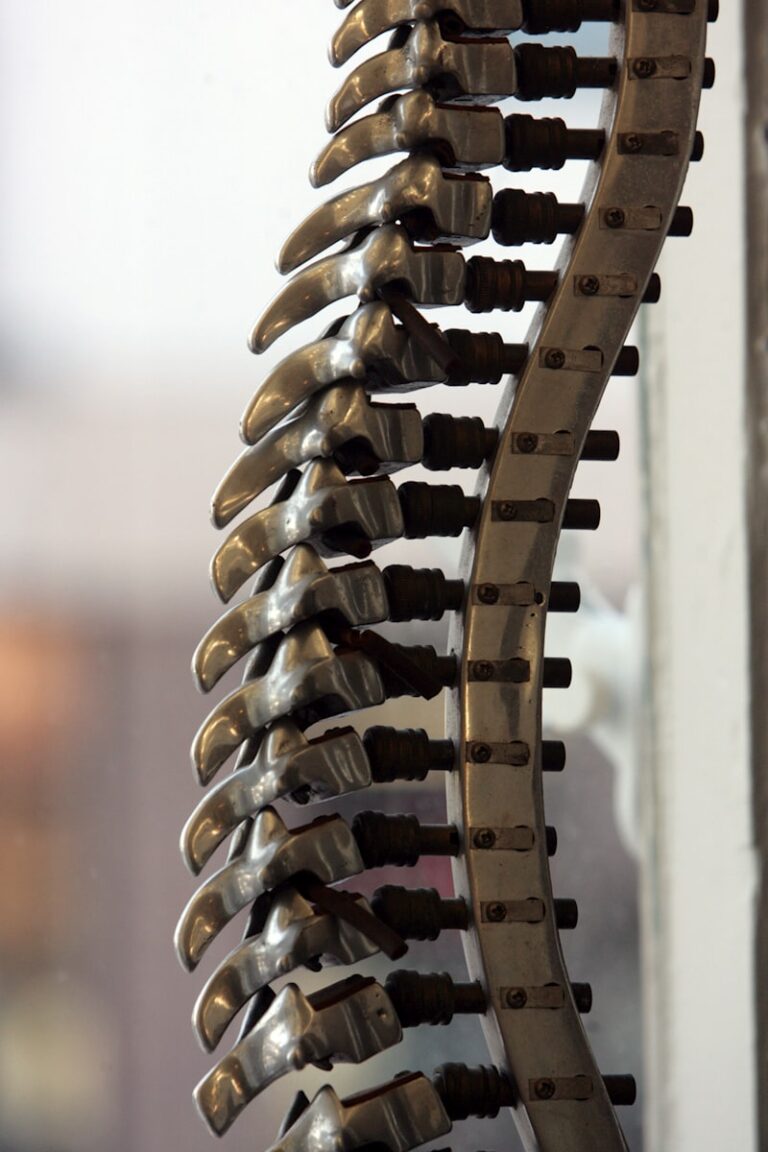 Brown-Sequard Syndrome: Decoding Split Spinal Pathways