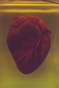 Cardiac Neurosis: When Fear Mimics Heart Disease