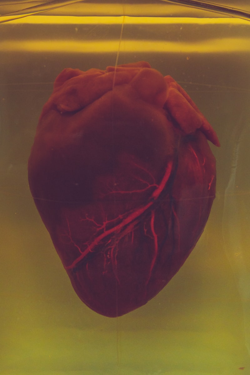 Cardiac Neurosis: When Fear Mimics Heart Disease