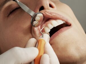 Dental Maturity: Assessing Growth Through Your Teeth
