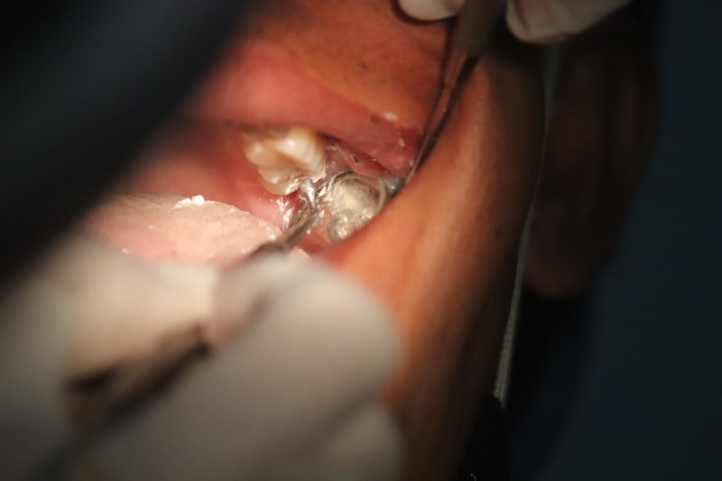 Morsicatio Buccarum: Stop the Cycle of Chronic Cheek Biting