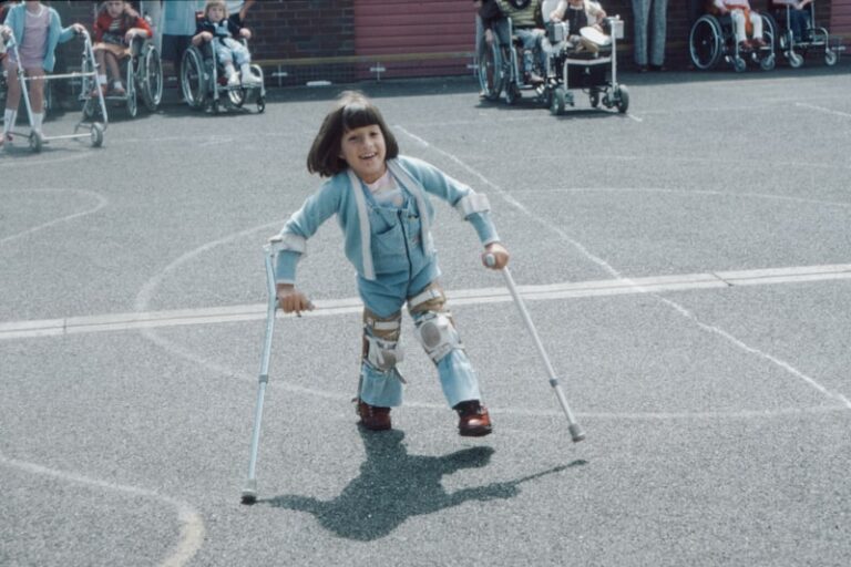 Motor Impairment: The Psychology of Movement