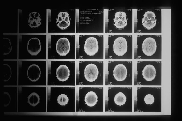 Neuroimaging: Mapping the Mind in 3D