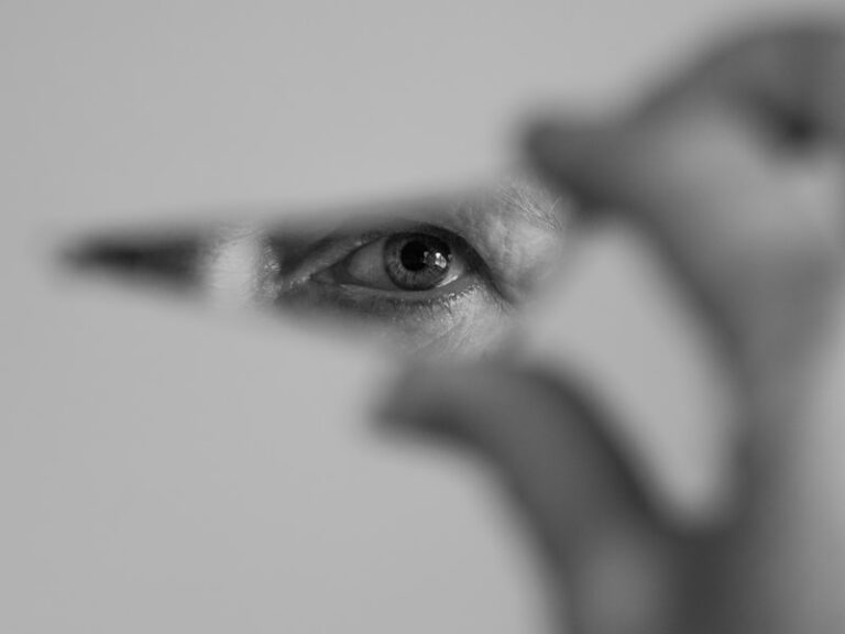 Ocular Misalignment: How Strabismus Shapes Self-Perception