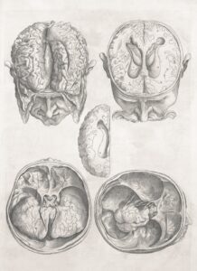 Platycephaly: The Hidden Psychology of Cranial Shape