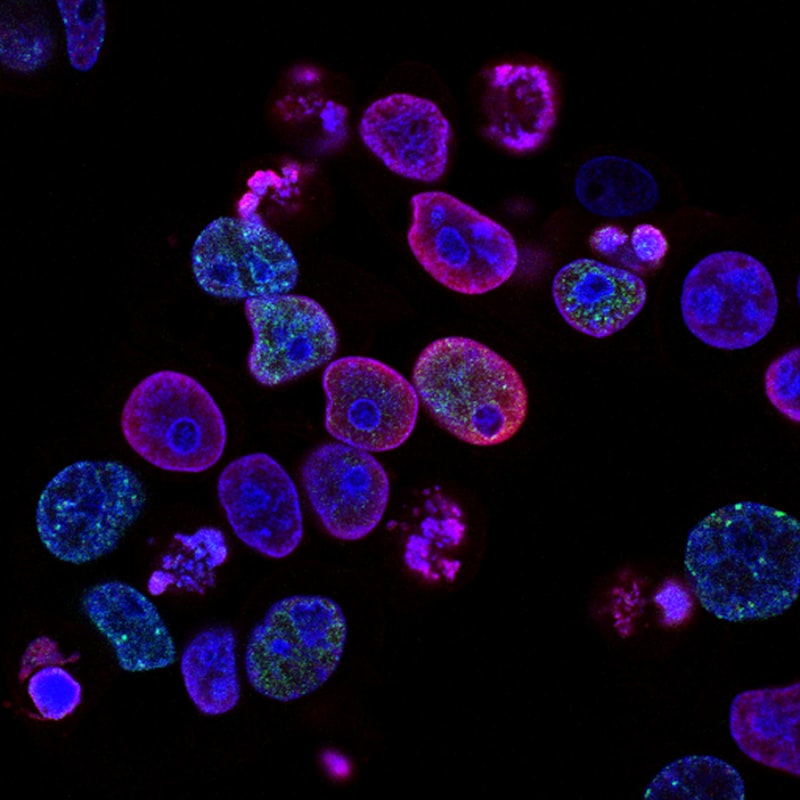 Programmed Cell Death: The Biology of Human Finitude