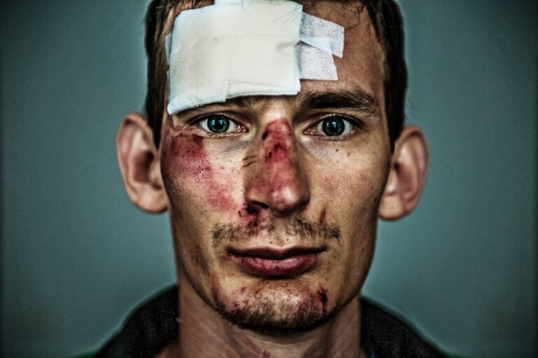 Traumatic Brain Injury: Unmasking the Invisible Wound