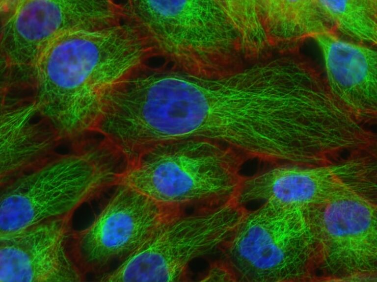 Visual Perception: How End-Stopped Cells Shape Reality
