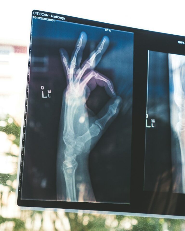 Bone Development: Understanding Localized Anomalies