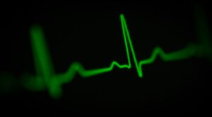 Cardiac Dysrhythmia: Why Your Heart Races Under Pressure