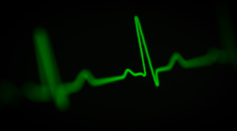 Cardiac Dysrhythmia: Why Your Heart Races Under Pressure