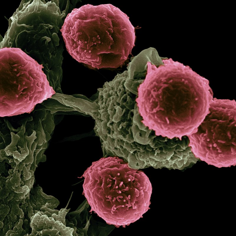 Cellular Autophagy: Rejuvenate Your Mind and Body