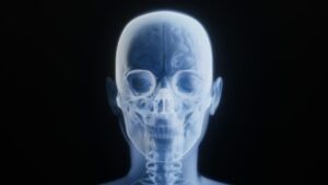 Craniofacial Anomalies: Decoding Rare Structural Impacts