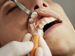 Dental Occlusion: The Hidden Key to Your Mental State