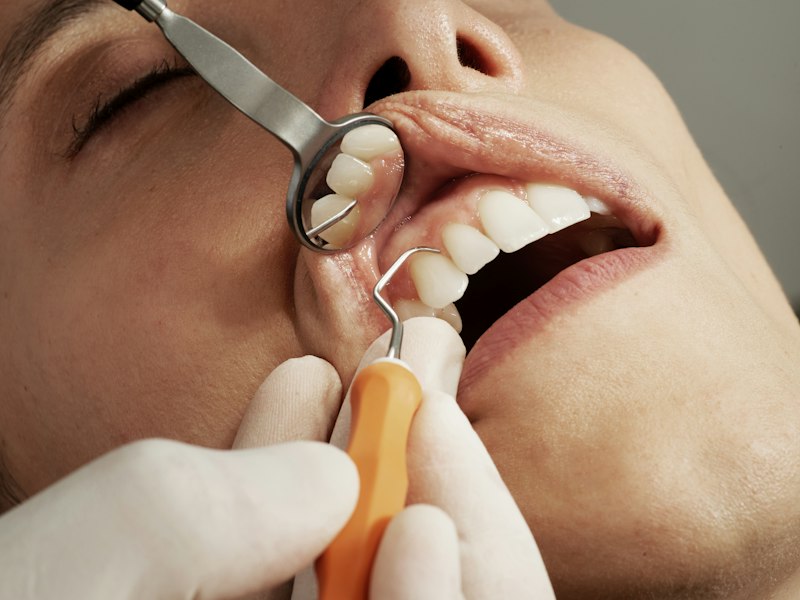 Dental Occlusion: The Hidden Key to Your Mental State