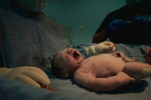Developmental Trauma: The Hidden Impact of Early ROP