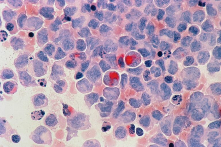 Gustatory Perception: Decoding the Vital Type III Cell
