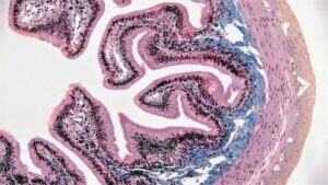 Micropsychosis: The Hidden Cost of Obsessing Over Details