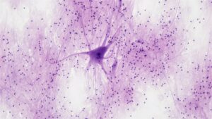 Motor Neuron Disease: Navigating the Loss of Control
